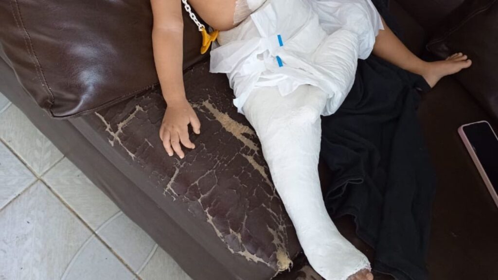 Mãe é denunciada em Manaus por lesão corporal contra bebê de 1 ano e 9 meses com perna fraturada